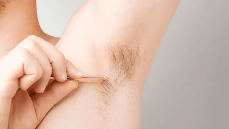 Can You Tweeze After Laser Hair Removal?