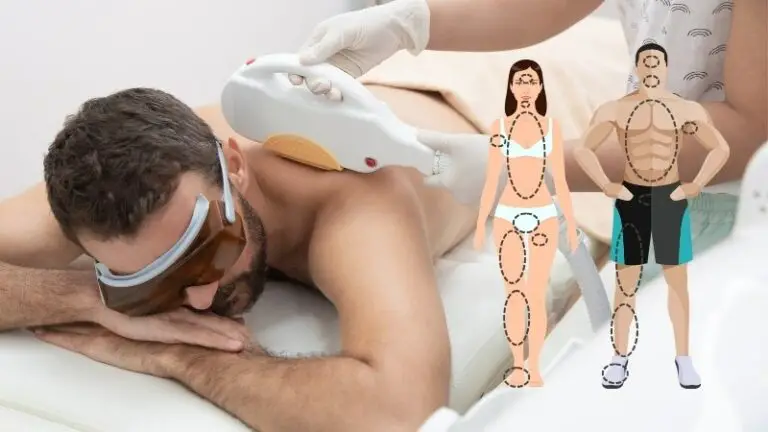Where to Get a Laser Hair Removal Size Chart