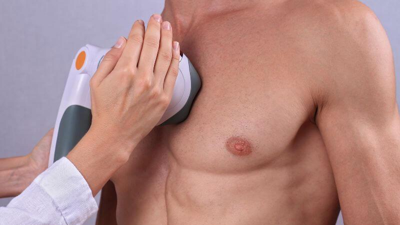 laser hair removal on a man's chest – what is considered a large area for laser hair removal