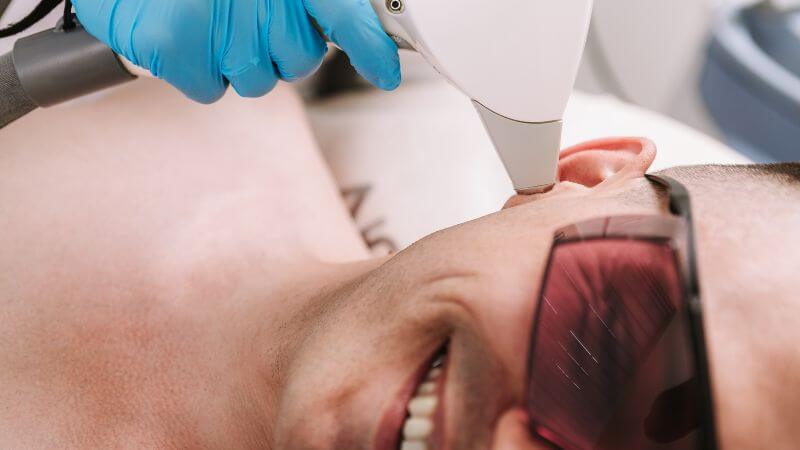 man lying on his side having laser hair removal for his sideburns – What Is A Small Area For Laser Hair Removal