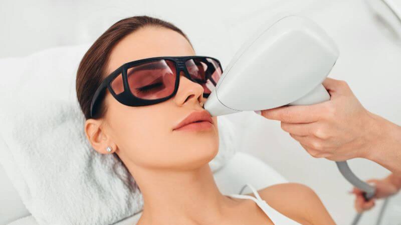 woman with eyes closed having upper lip hair removed with laser – What Is A Small Area For Laser Hair Removal?