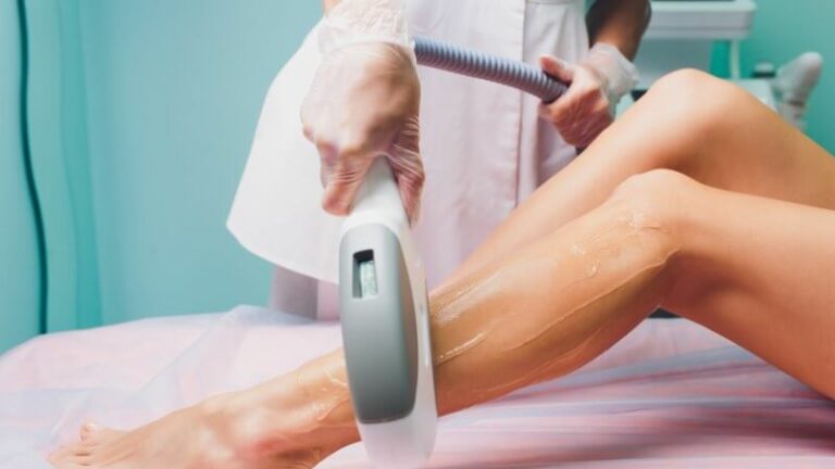 Can I Stop Laser Hair Removal?
